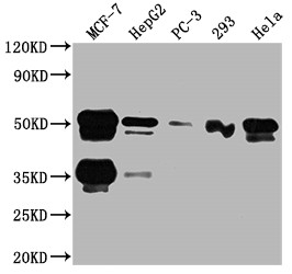 FOXA1 Antibody in Western Blot (WB)