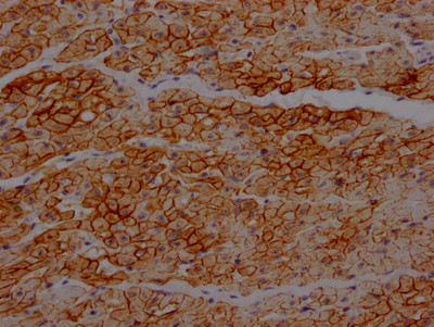 Dystrophin Antibody in Immunohistochemistry (Paraffin) (IHC (P))