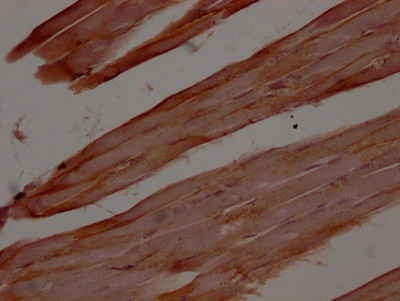 Dystrophin Antibody in Immunohistochemistry (Paraffin) (IHC (P))