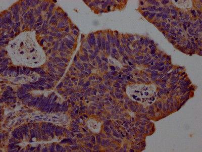 CXCL10 Antibody in Immunohistochemistry (Paraffin) (IHC (P))