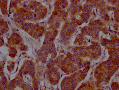 IL-4 Antibody in Immunohistochemistry (Paraffin) (IHC (P))