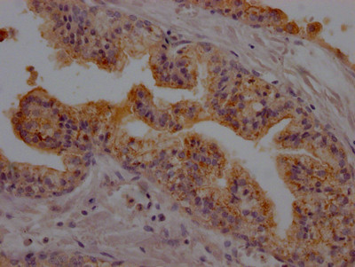 CD26 Antibody in Immunohistochemistry (Paraffin) (IHC (P))