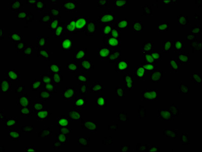 PARP1 Antibody in Immunocytochemistry (ICC/IF)