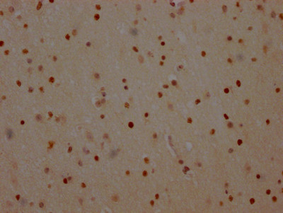 PARP1 Antibody in Immunohistochemistry (Paraffin) (IHC (P))