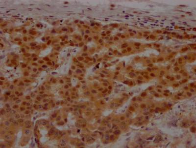 PARP1 Antibody in Immunohistochemistry (Paraffin) (IHC (P))