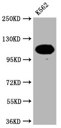 PARP1 Antibody in Western Blot (WB)