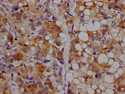 ApoC3 Antibody in Immunohistochemistry (Paraffin) (IHC (P))