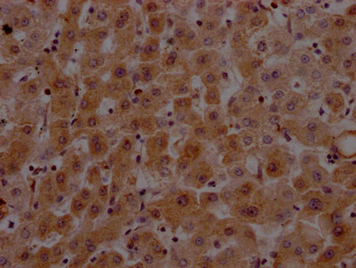 Prothrombin Antibody in Immunohistochemistry (Paraffin) (IHC (P))