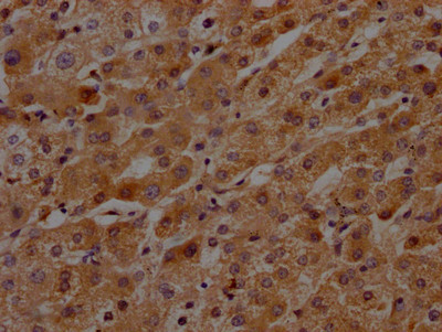 Plasma Kallikrein Antibody in Immunohistochemistry (Paraffin) (IHC (P))