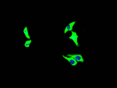 Growth Hormone Receptor Antibody in Immunocytochemistry (ICC/IF)