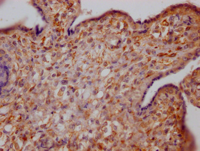 Growth Hormone Receptor Antibody in Immunohistochemistry (Paraffin) (IHC (P))