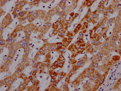 Angiopoietin 2 Antibody in Immunohistochemistry (Paraffin) (IHC (P))