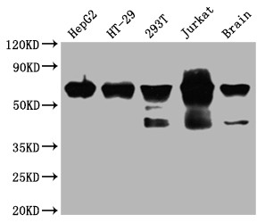 DDX5 Antibody in Western Blot (WB)