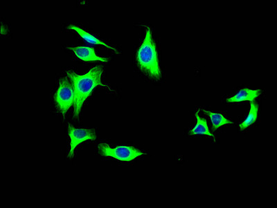 LOXL2 Antibody in Immunocytochemistry (ICC/IF)