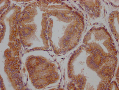 LOXL2 Antibody in Immunohistochemistry (Paraffin) (IHC (P))