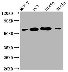 LOXL2 Antibody in Western Blot (WB)