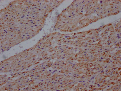 UQCRC2 Antibody in Immunohistochemistry (Paraffin) (IHC (P))