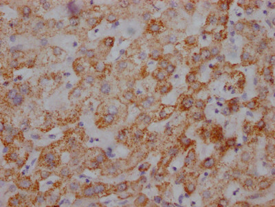 UQCRC2 Antibody in Immunohistochemistry (Paraffin) (IHC (P))