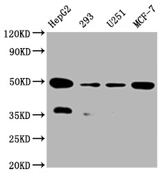 UQCRC2 Antibody in Western Blot (WB)