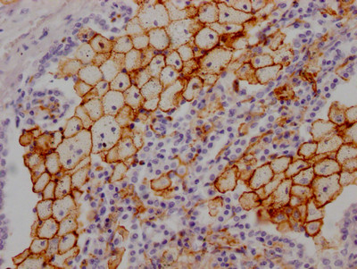 ACE Antibody in Immunohistochemistry (Paraffin) (IHC (P))