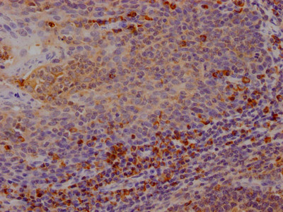 CTLA-4 Antibody in Immunohistochemistry (Paraffin) (IHC (P))