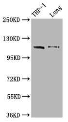 MDA5 Antibody in Western Blot (WB)