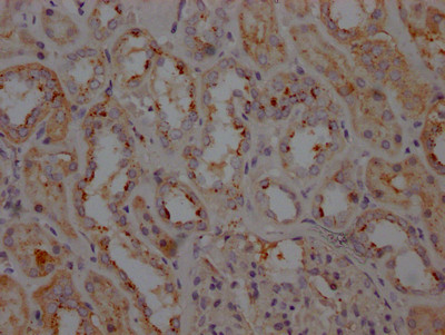 LRRK2 Antibody in Immunohistochemistry (Paraffin) (IHC (P))