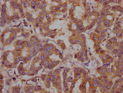 GRP78 Antibody in Immunohistochemistry (Paraffin) (IHC (P))