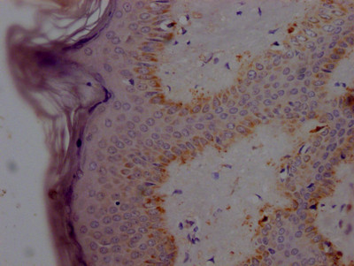 alpha Synuclein Antibody in Immunohistochemistry (Paraffin) (IHC (P))