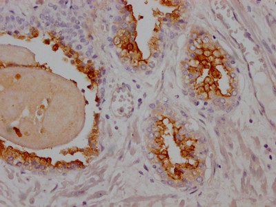 PSMA Antibody in Immunohistochemistry (Paraffin) (IHC (P))