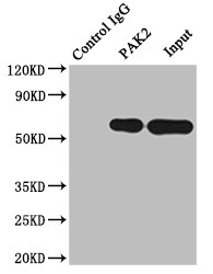 PAK2 Antibody in Immunoprecipitation (IP)