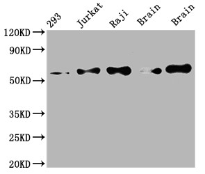 PAK2 Antibody in Western Blot (WB)