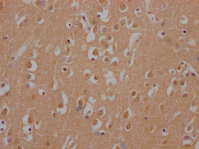 Huntingtin Antibody in Immunohistochemistry (Paraffin) (IHC (P))