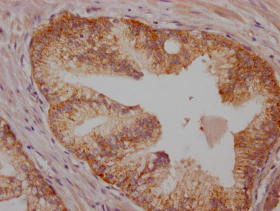 B-Raf Antibody in Immunohistochemistry (Paraffin) (IHC (P))