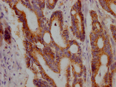 JAK1 Antibody in Immunohistochemistry (Paraffin) (IHC (P))