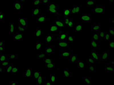 Aldolase A Antibody in Immunocytochemistry (ICC/IF)