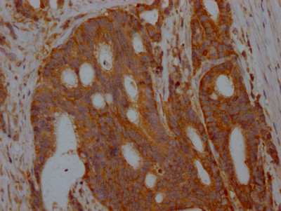 Aldolase A Antibody in Immunohistochemistry (Paraffin) (IHC (P))