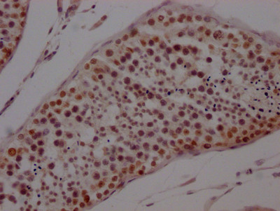 PTBP1 Antibody in Immunohistochemistry (Paraffin) (IHC (P))