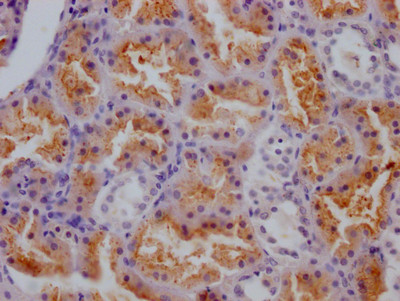 Cathepsin S Antibody in Immunohistochemistry (Paraffin) (IHC (P))