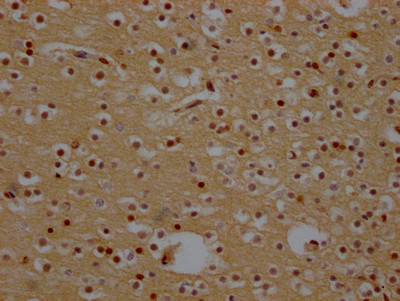 CRM1 Antibody in Immunohistochemistry (Paraffin) (IHC (P))