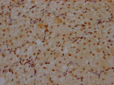 CRM1 Antibody in Immunohistochemistry (Paraffin) (IHC (P))