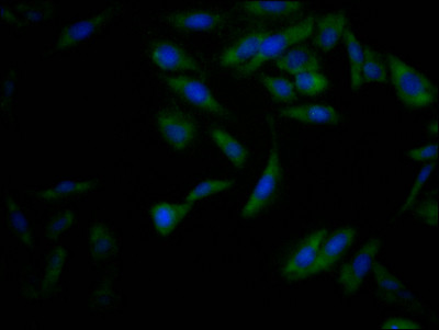 Nrf2 Antibody in Immunocytochemistry (ICC/IF)