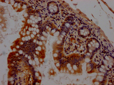 Chk1 Antibody in Immunohistochemistry (Paraffin) (IHC (P))