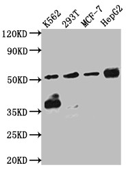 Chk1 Antibody in Western Blot (WB)