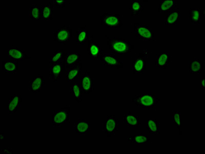 Cyclin E Antibody in Immunocytochemistry (ICC/IF)