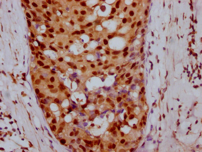 Cyclin E Antibody in Immunohistochemistry (Paraffin) (IHC (P))