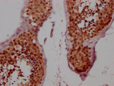 Cyclin E Antibody in Immunohistochemistry (Paraffin) (IHC (P))