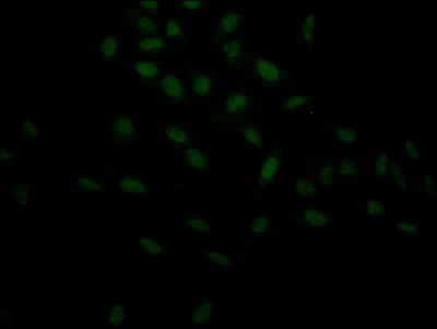 HIF1A Antibody in Immunocytochemistry (ICC/IF)