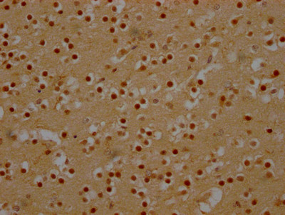 DDX6 Antibody in Immunohistochemistry (Paraffin) (IHC (P))