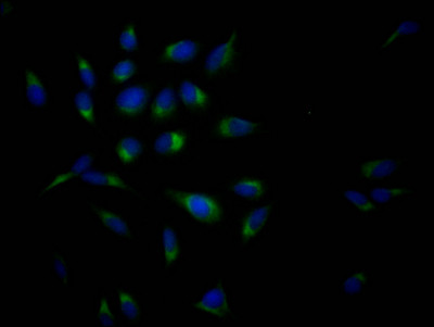 Amyloid Precursor Protein Antibody in Immunocytochemistry (ICC/IF)